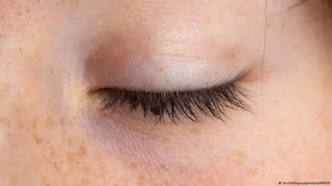 سيروم الرموش: مخاطر صحية محتملة
